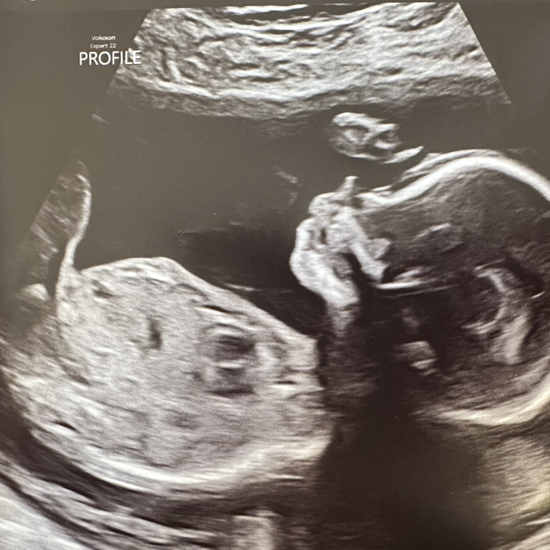 Photo shared by Rosie for their Babylist baby registry.