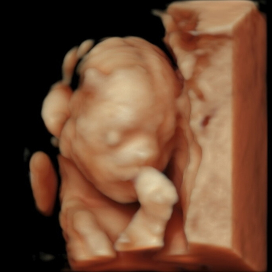 Photo shared by Jenny for their Babylist baby registry.