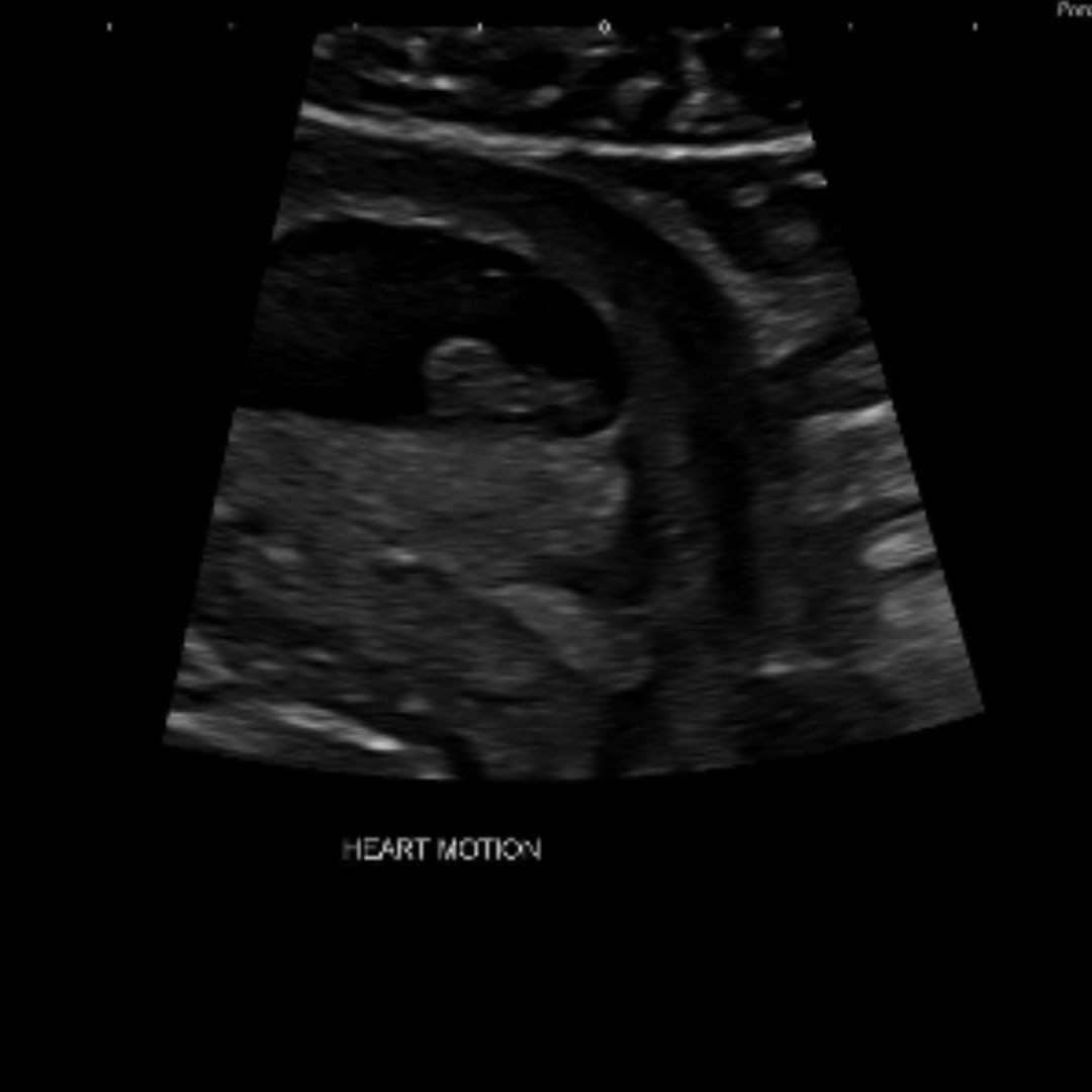 Photo shared by Makayla for their Babylist baby registry.