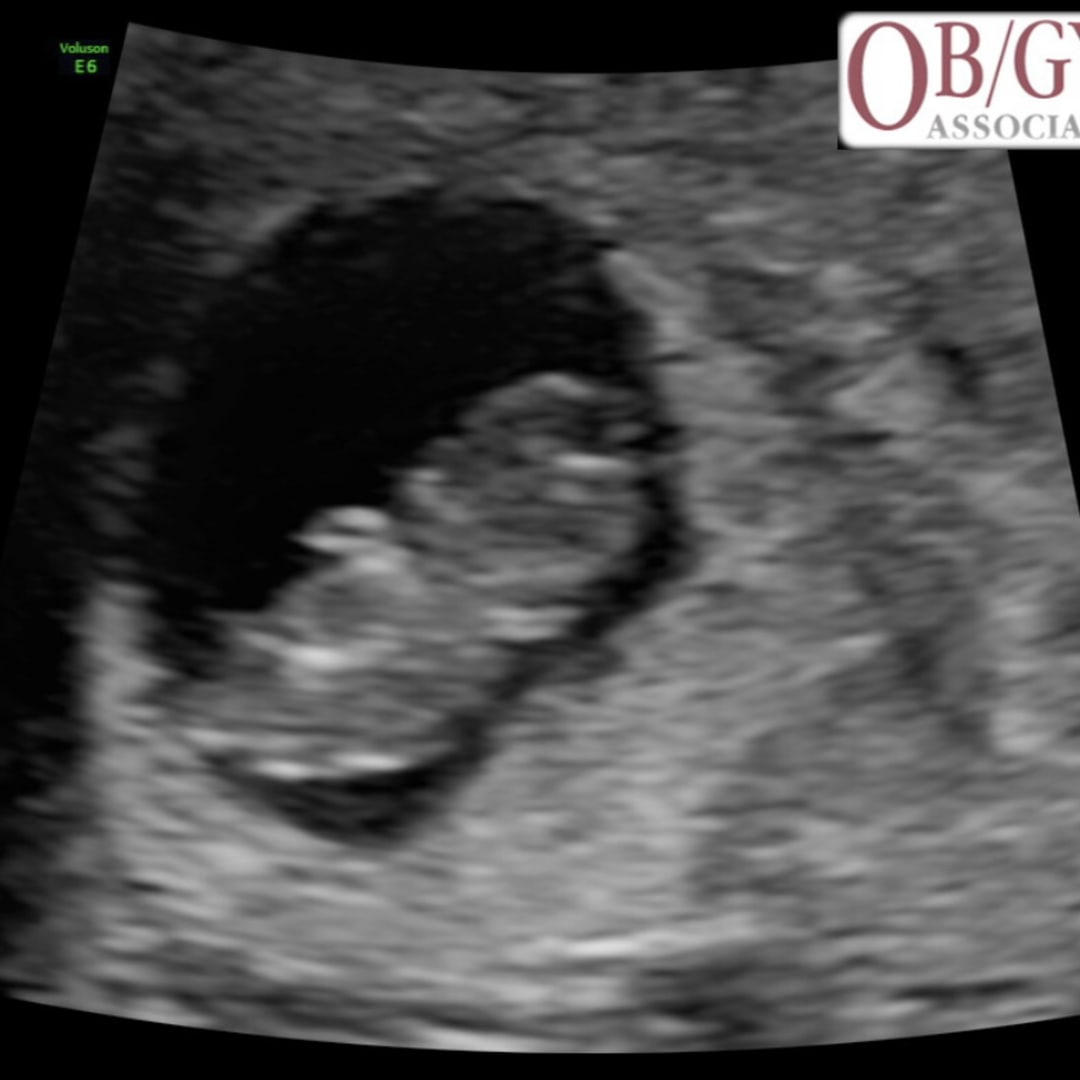 Photo shared by Jade for their Babylist baby registry.