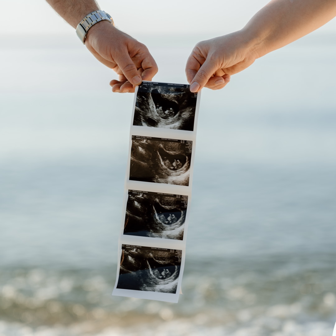 Photo shared by Victoria for their Babylist baby registry.