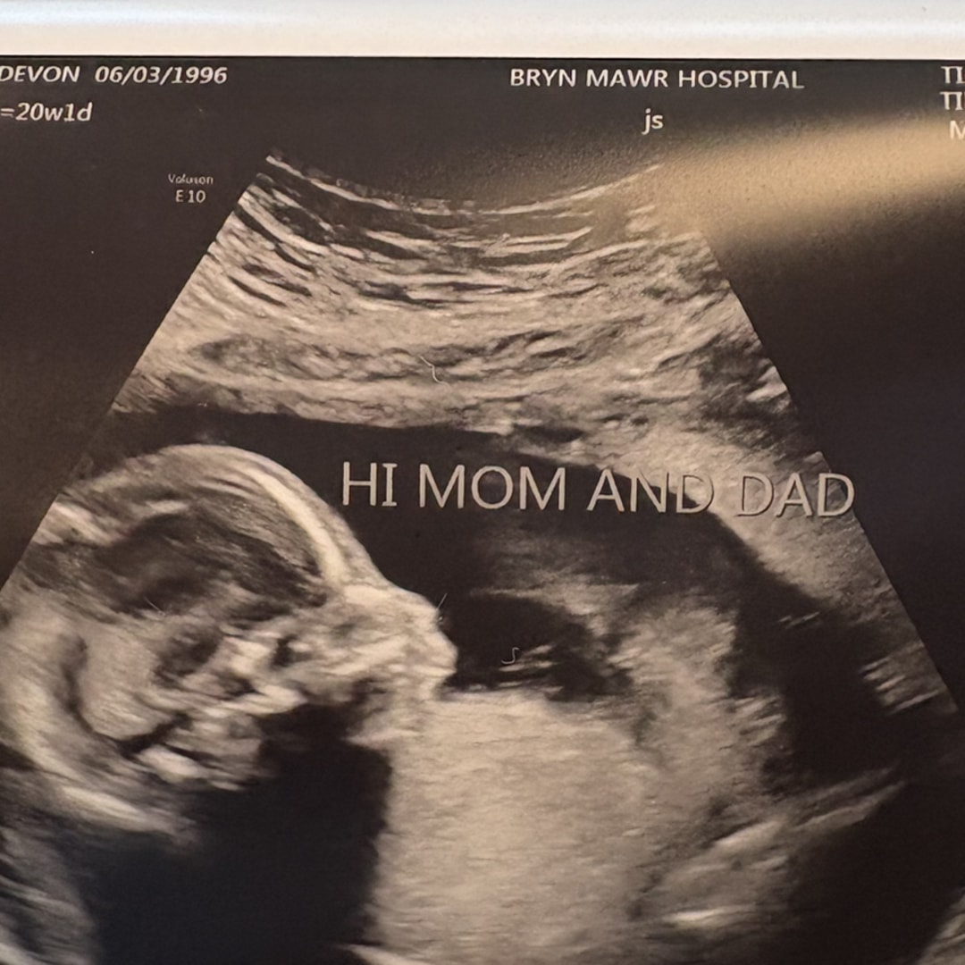 Photo shared by Devon for their Babylist baby registry.