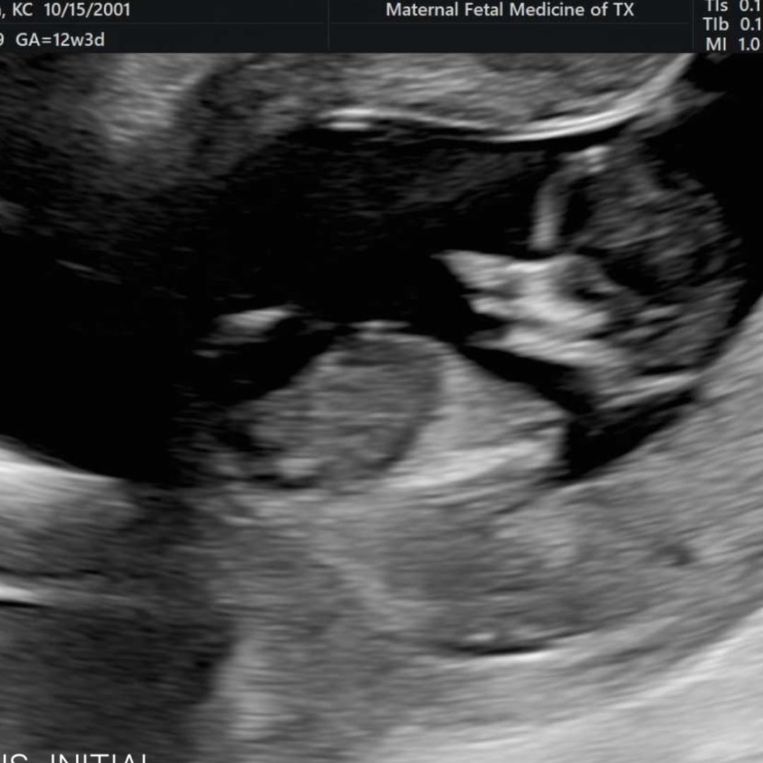 Photo shared by KC for their Babylist baby registry.