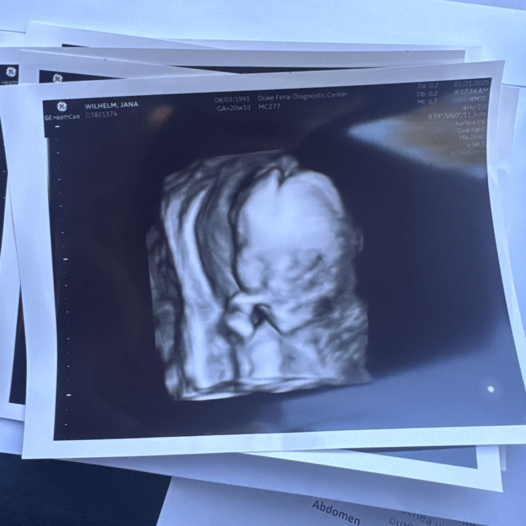 Photo shared by Jana for their Babylist baby registry.