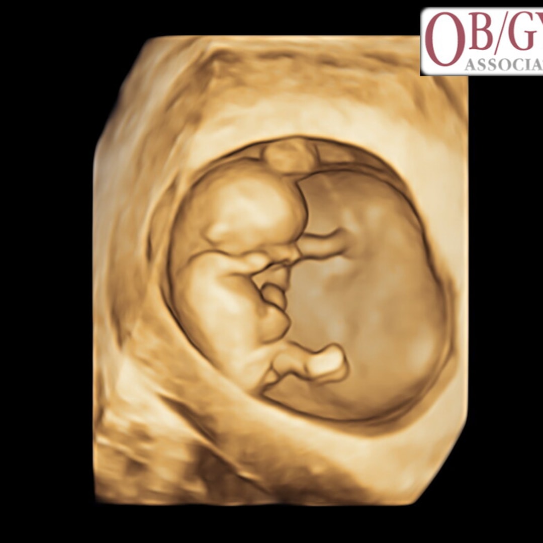 Photo shared by Aubrey for their Babylist baby registry.