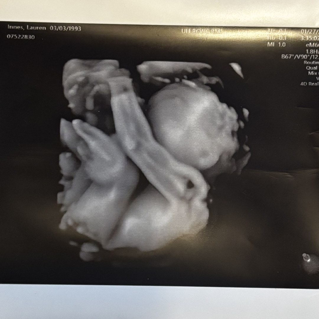 Photo shared by Lauren for their Babylist baby registry.