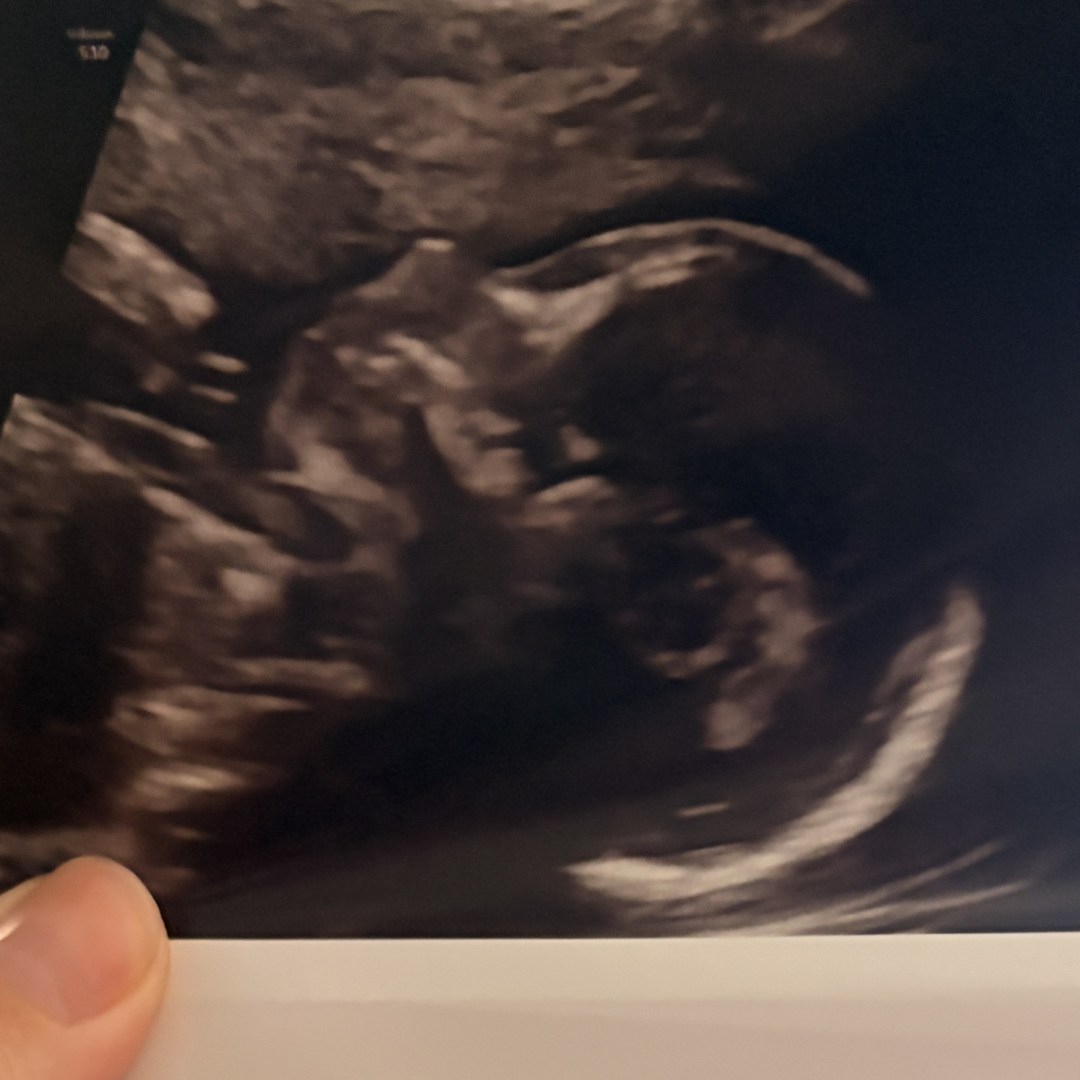 Photo shared by Eryn for their Babylist baby registry.