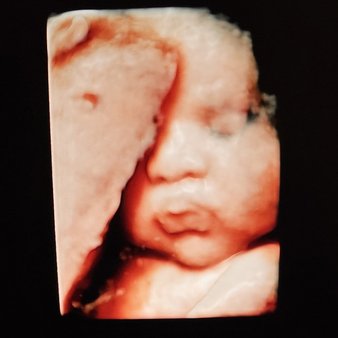 Photo shared by Micela for their Babylist baby registry.