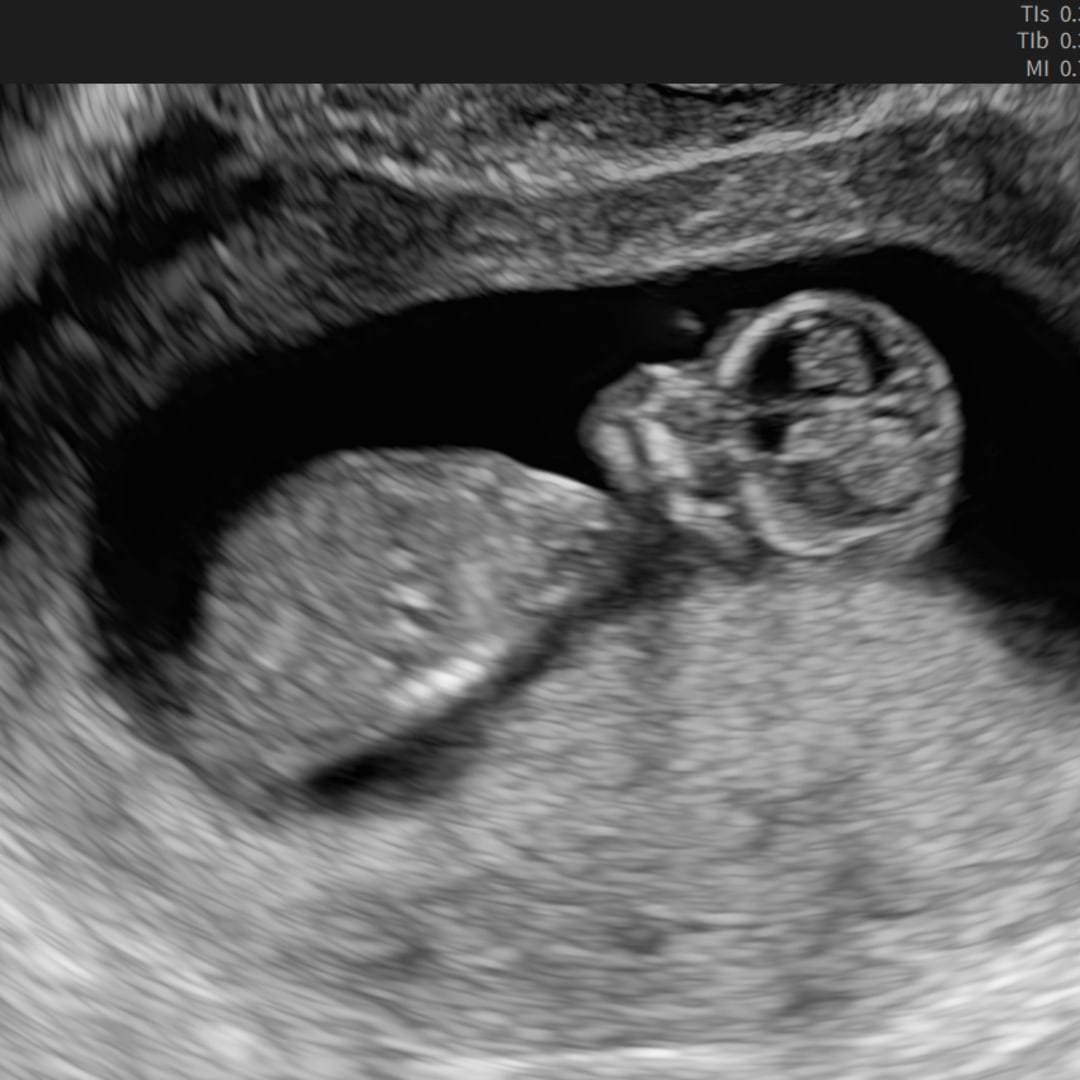 Photo shared by Lorraine for their Babylist baby registry.