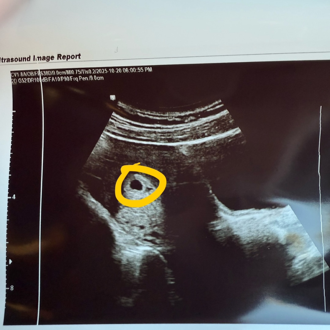 Photo shared by Ashley for their Babylist baby registry.