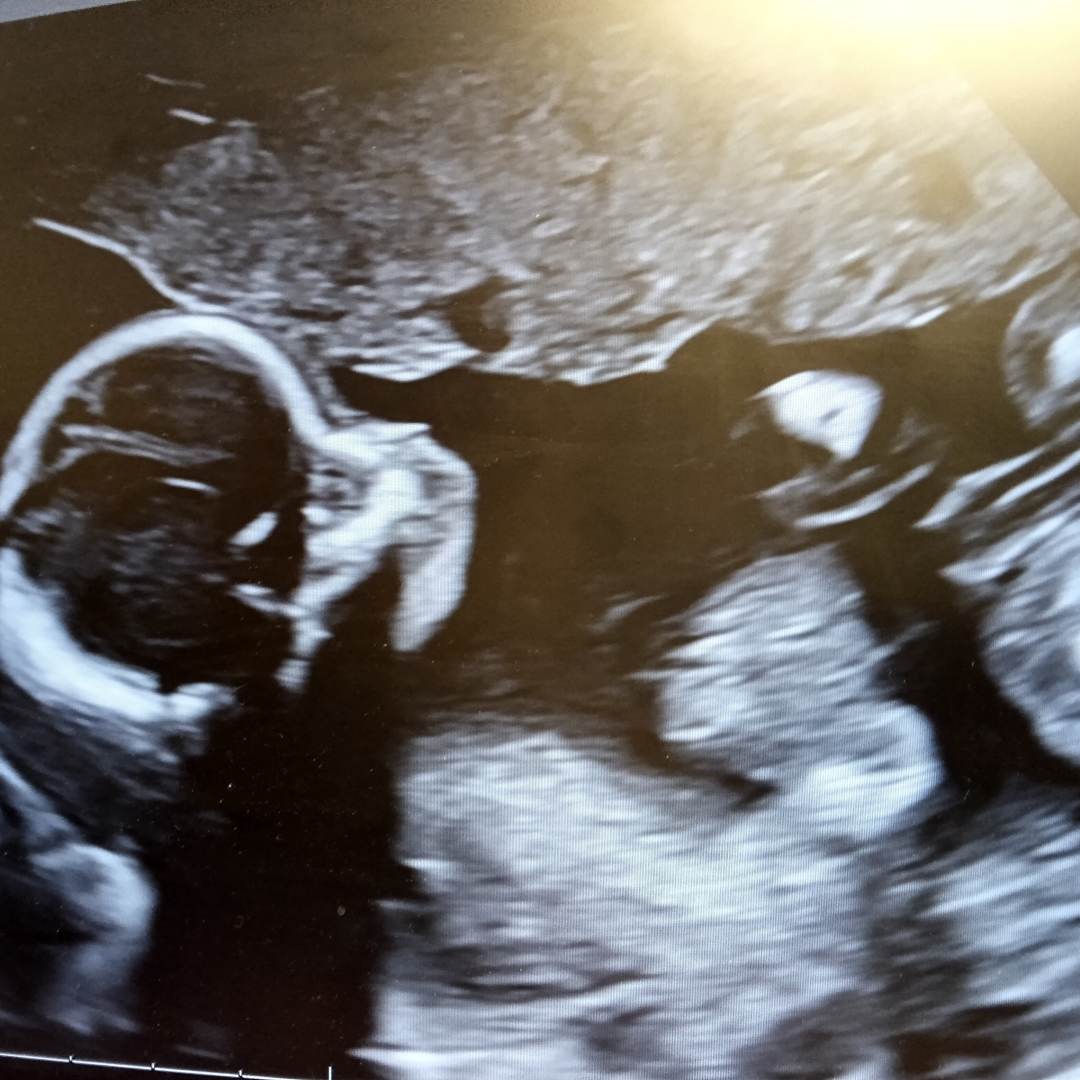 Photo shared by Victoria for their Babylist baby registry.