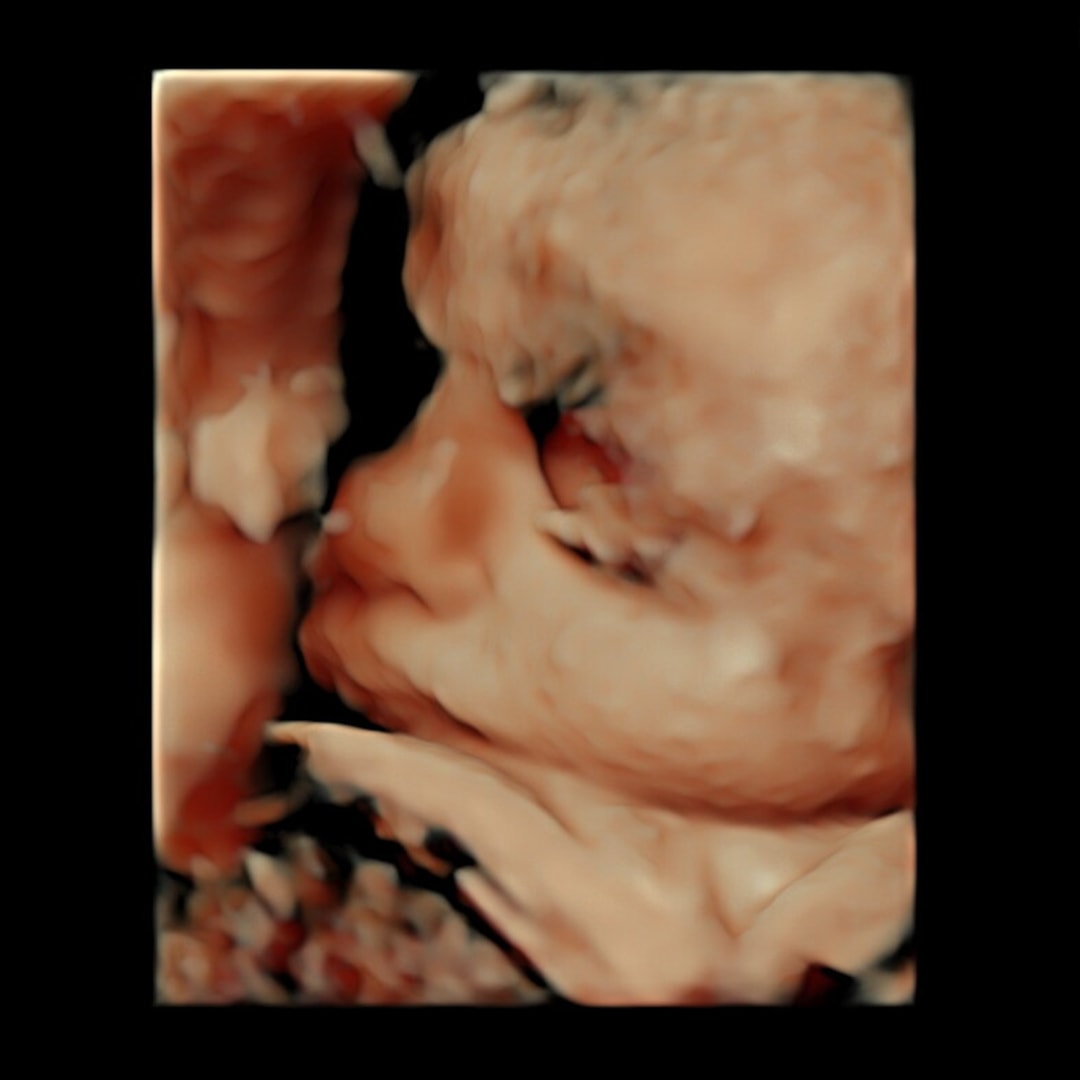 Photo shared by Jade for their Babylist baby registry.