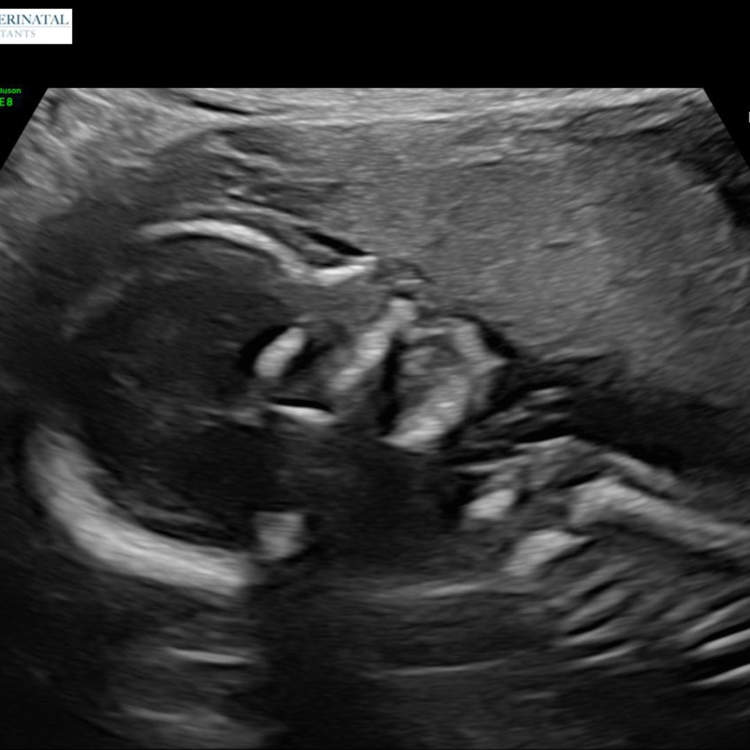 Photo shared by Cile for their Babylist baby registry.