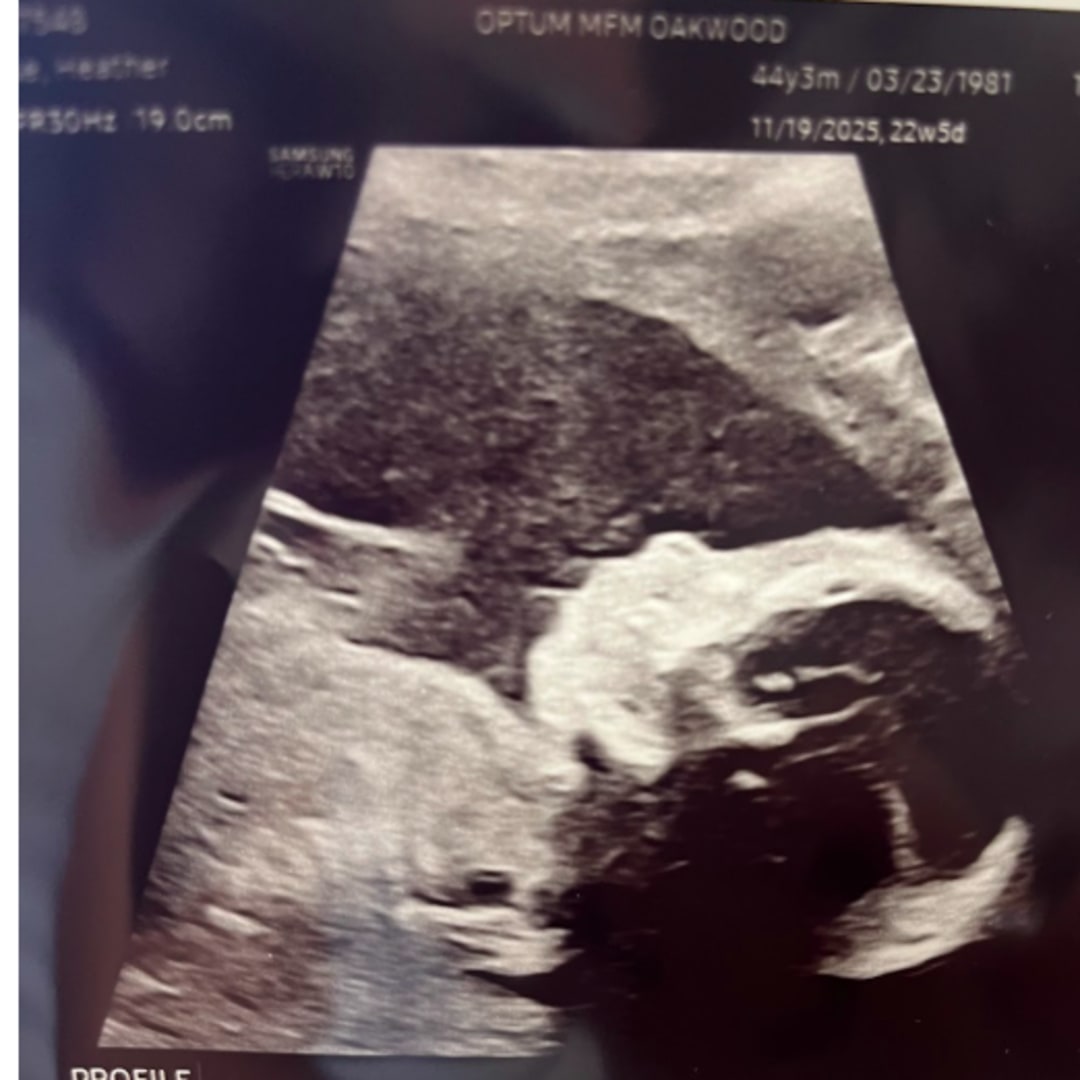 Photo shared by Heather for their Babylist baby registry.