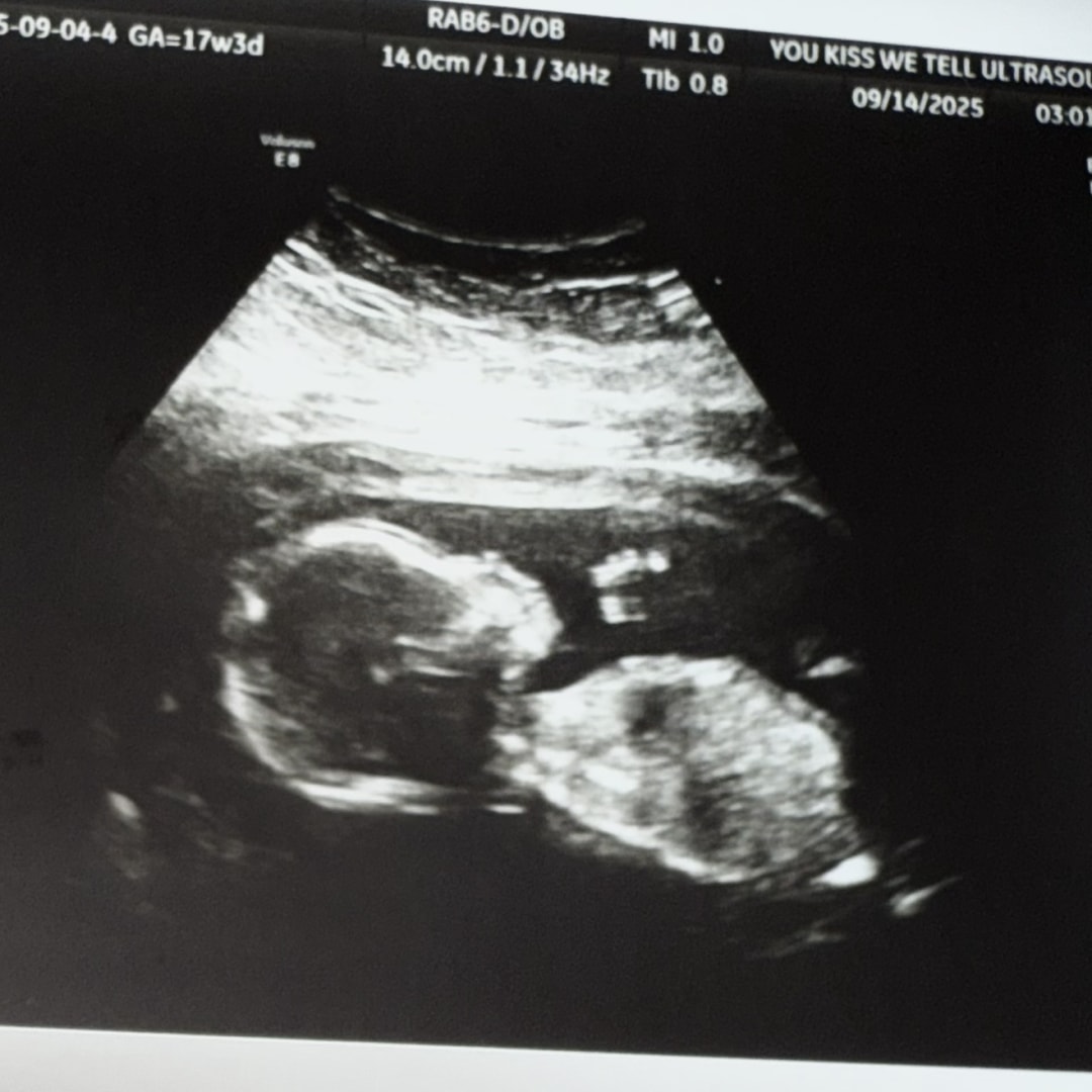 Photo shared by Alicia for their Babylist baby registry.