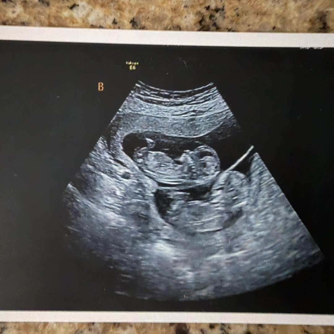 Photo shared by Ashley for their Babylist baby registry.
