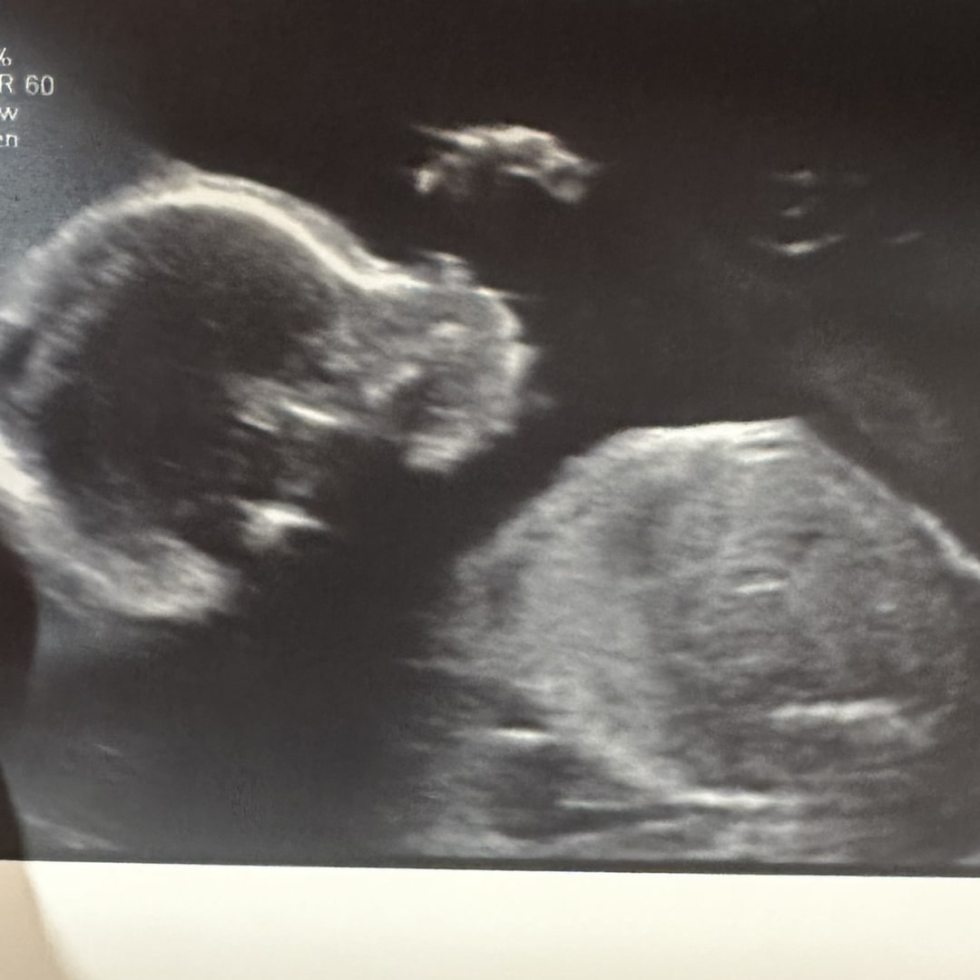 Photo shared by Jerica for their Babylist baby registry.