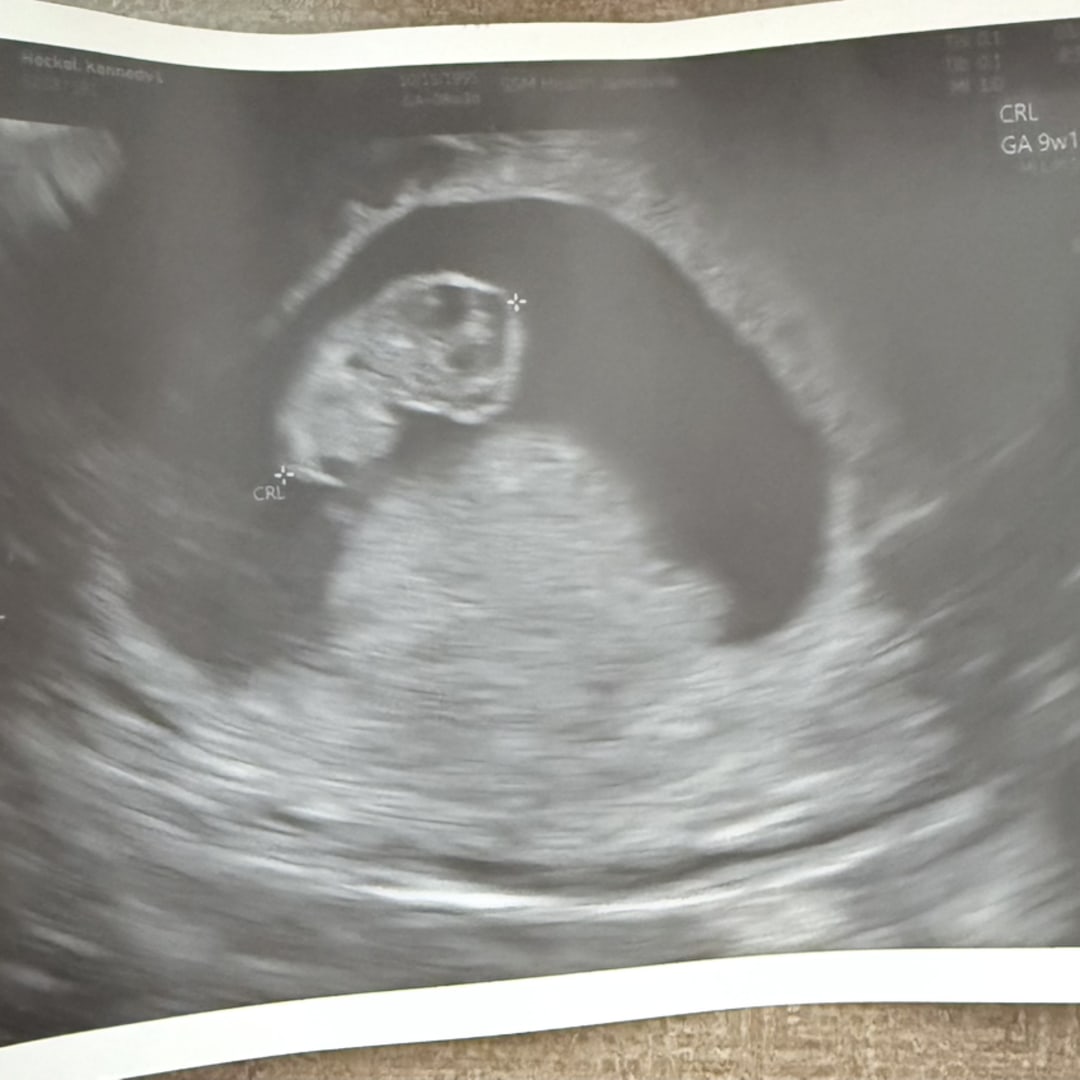 Photo shared by Kennedy for their Babylist baby registry.