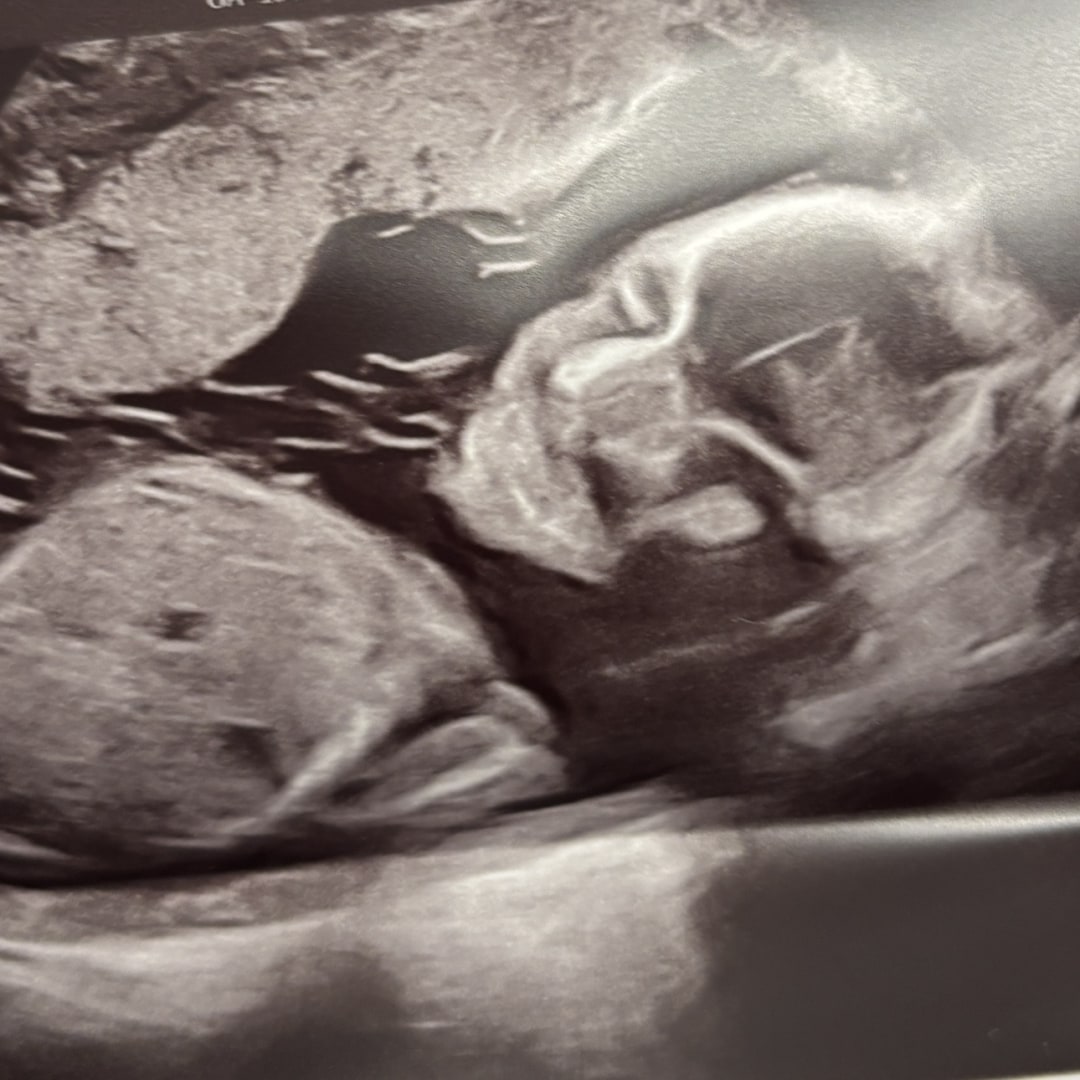 Photo shared by Emma for their Babylist baby registry.