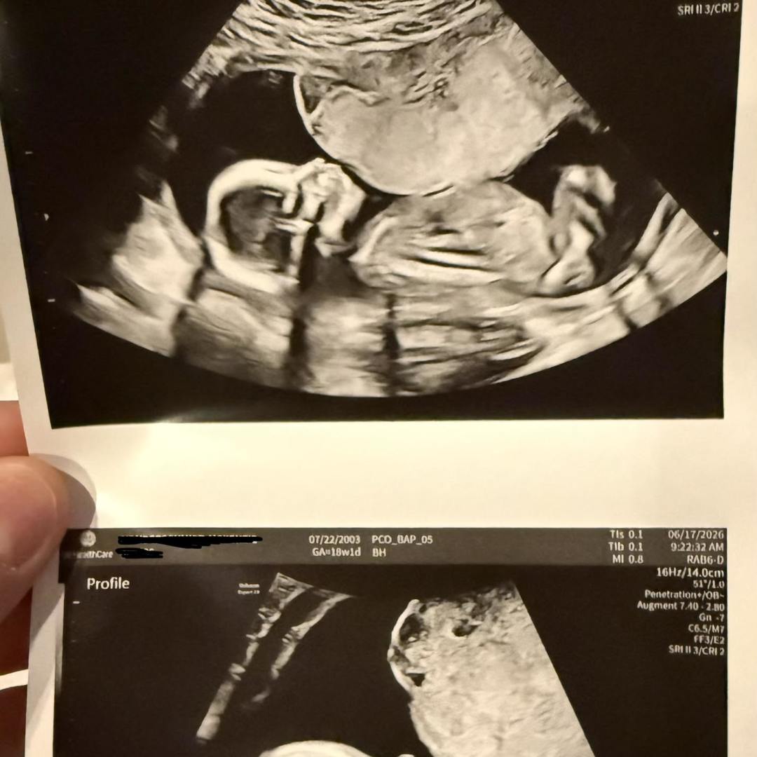 Photo shared by McKenzie for their Babylist baby registry.
