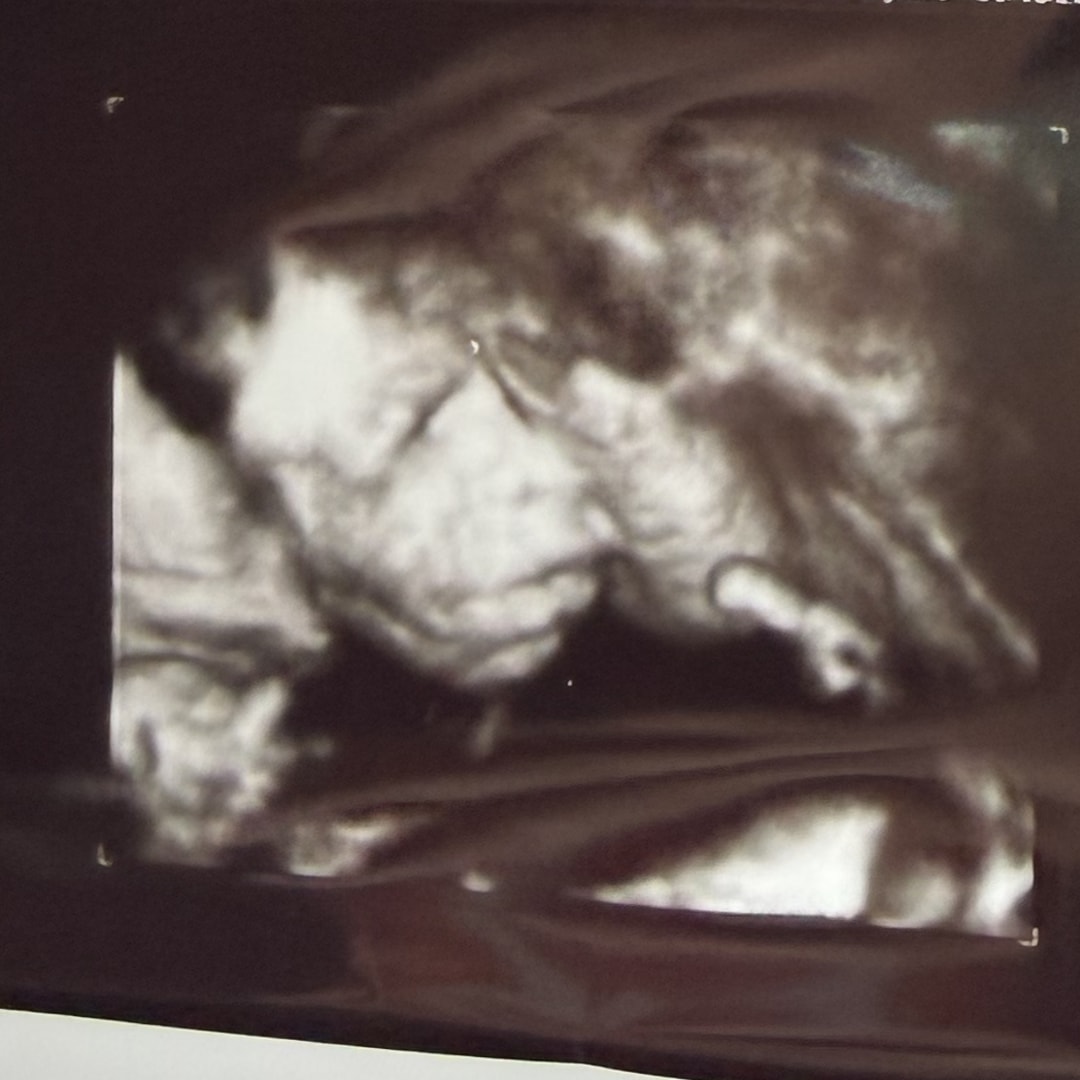 Photo shared by Victoria for their Babylist baby registry.