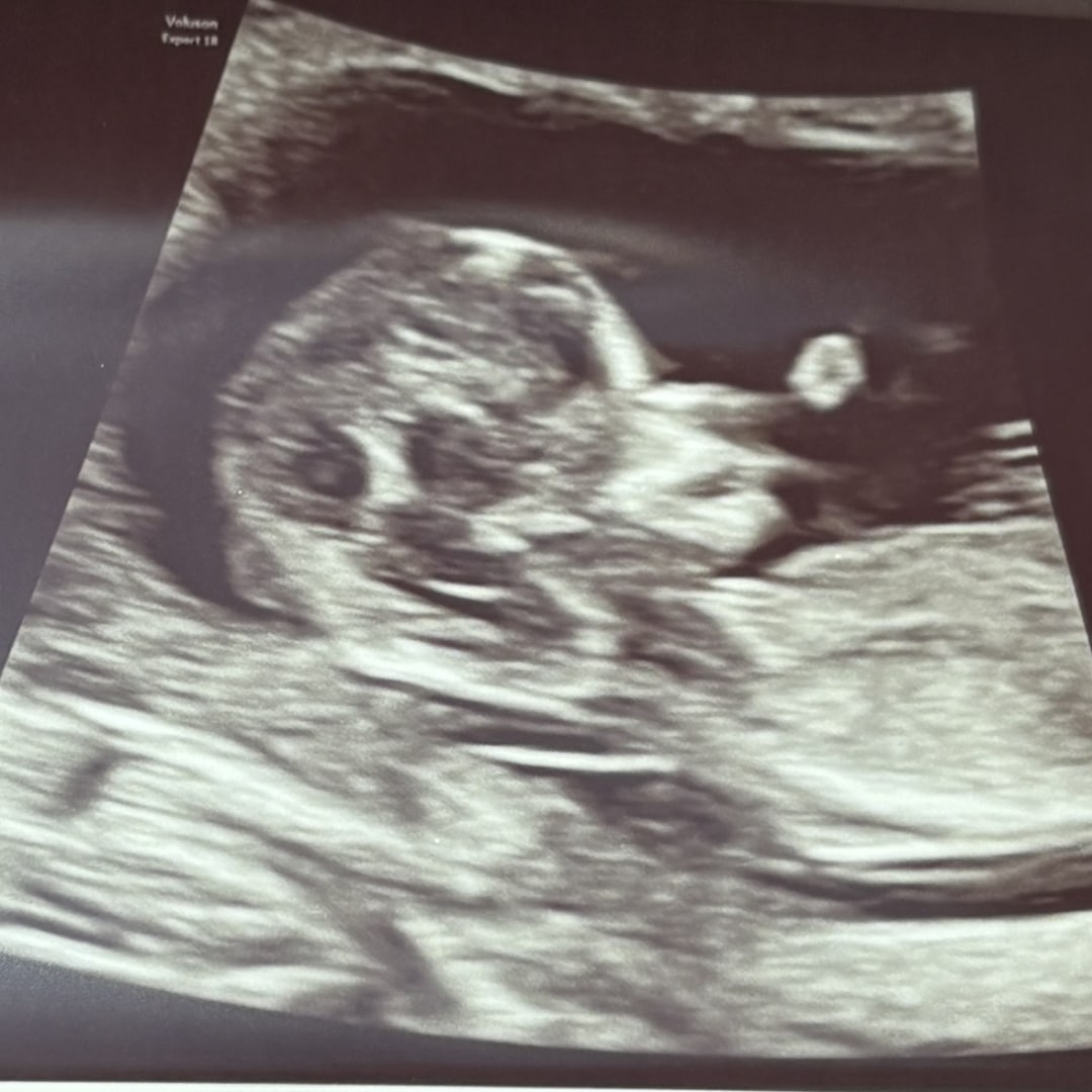 Photo shared by Courtney for their Babylist baby registry.