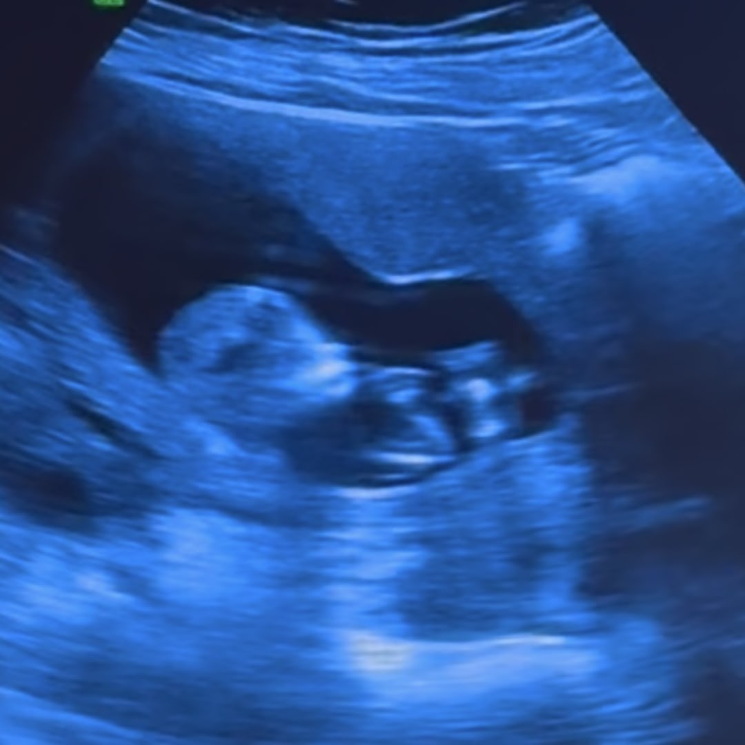 Photo shared by Brittney for their Babylist baby registry.