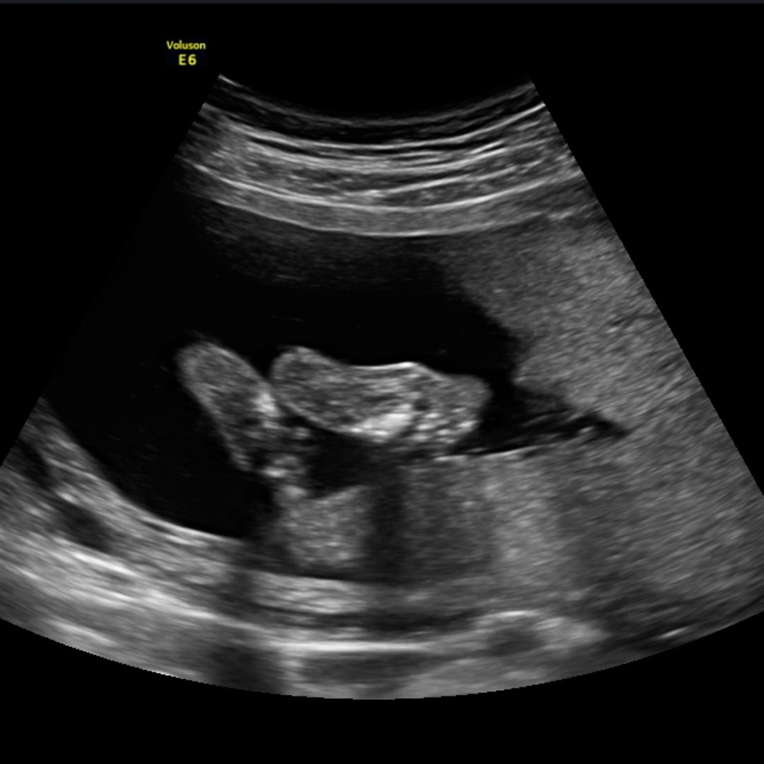 Photo shared by Erin for their Babylist baby registry.