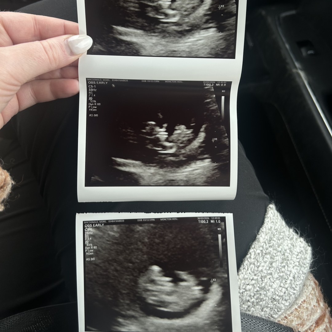 Photo shared by Morgan for their Babylist baby registry.