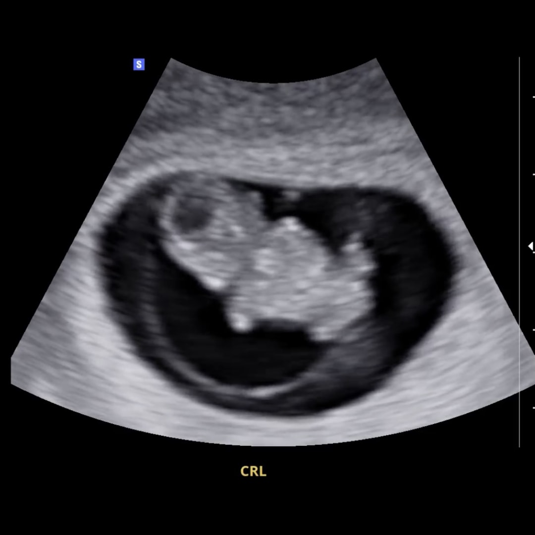 Photo shared by Gracie for their Babylist baby registry.