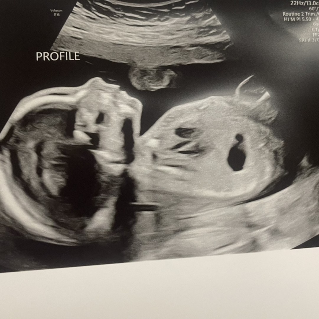 Photo shared by McKenzie for their Babylist baby registry.