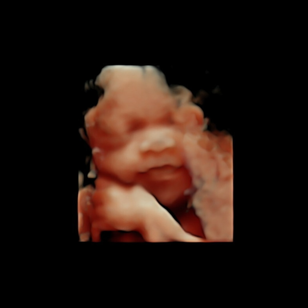 Photo shared by Janille Princess for their Babylist baby registry.