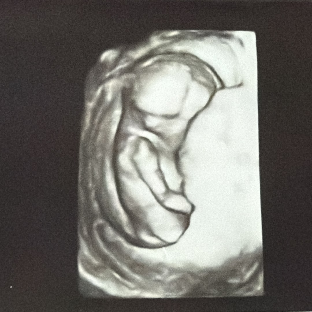 Photo shared by Sofia for their Babylist baby registry.