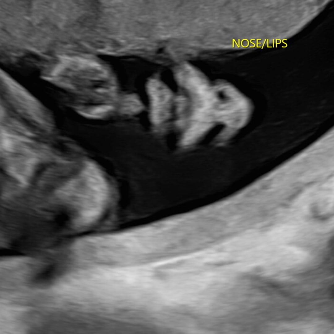 Photo shared by Jessica for their Babylist baby registry.