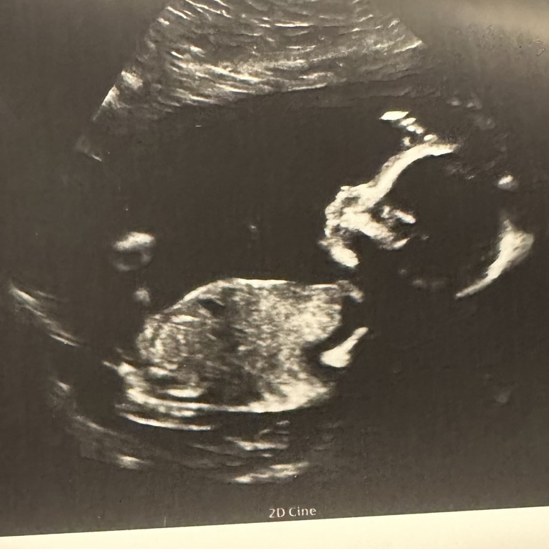 Photo shared by Katie for their Babylist baby registry.