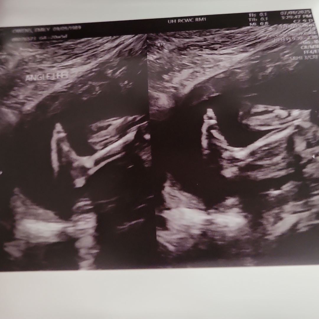 Photo shared by Emily for their Babylist baby registry.