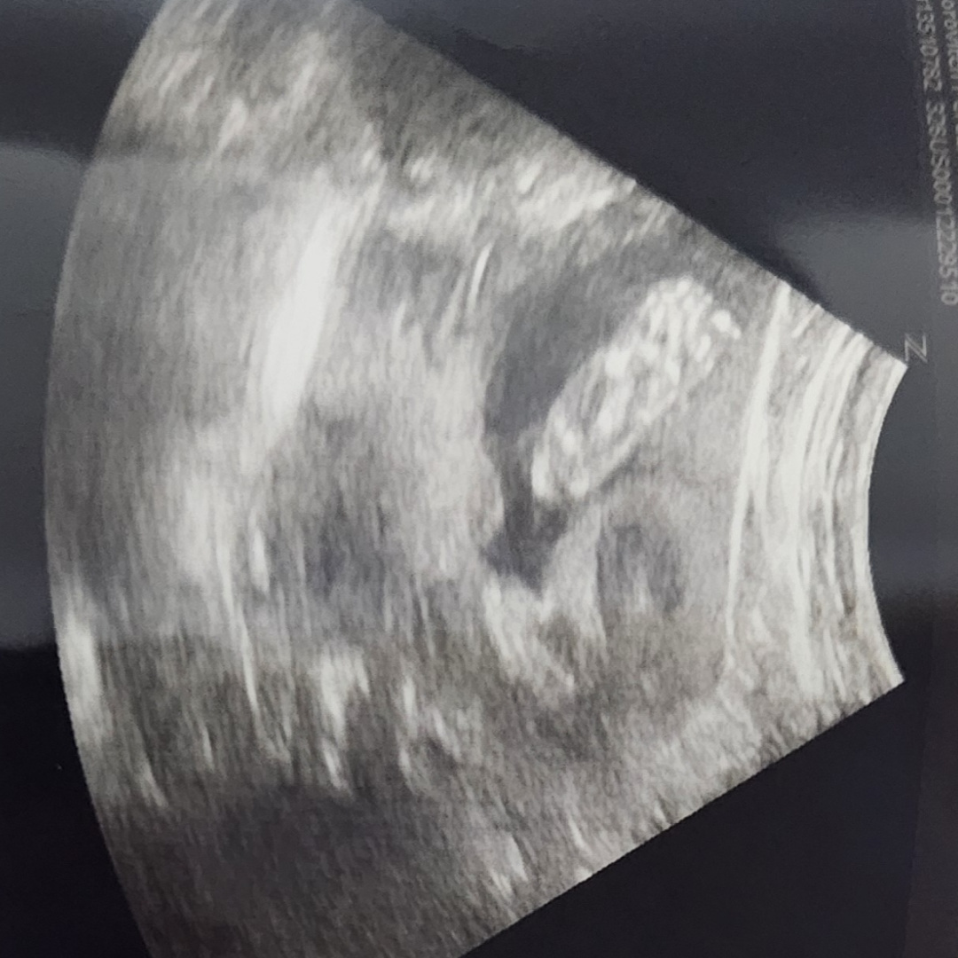 Photo shared by Jessenia for their Babylist baby registry.