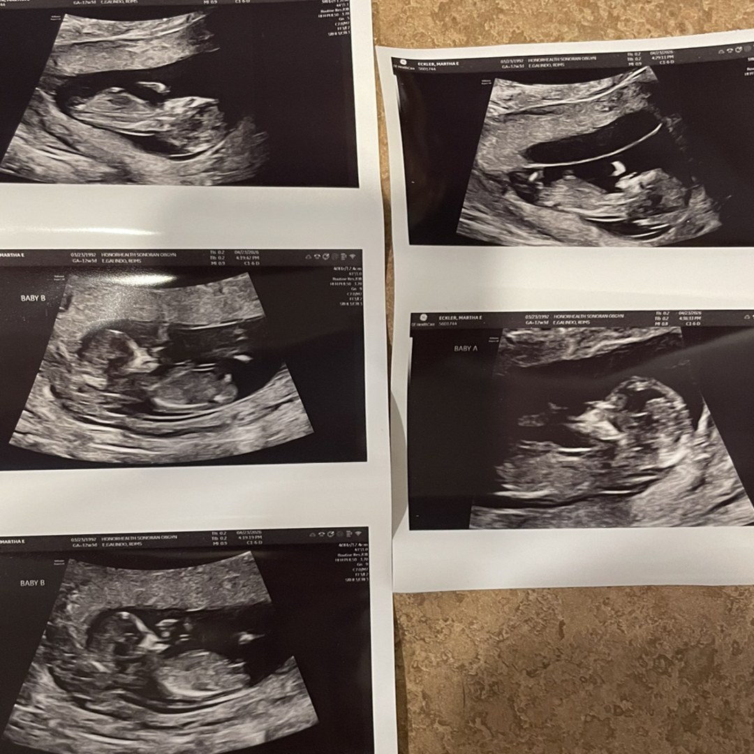 Photo shared by Martha for their Babylist baby registry.