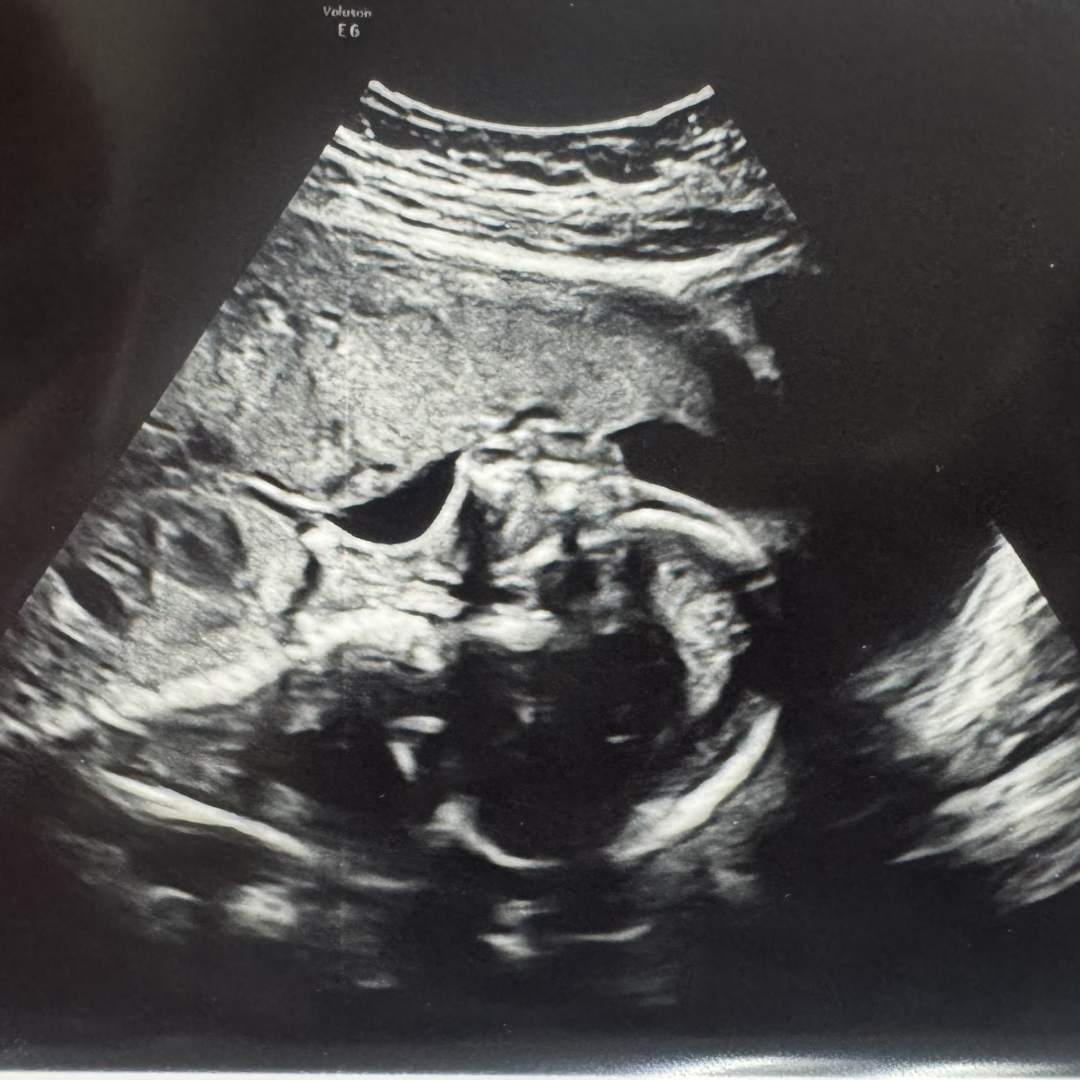 Photo shared by Gentry for their Babylist baby registry.