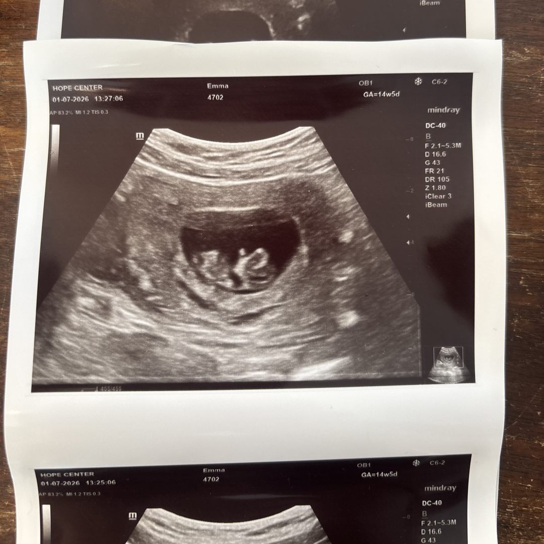 Photo shared by Emma for their Babylist baby registry.