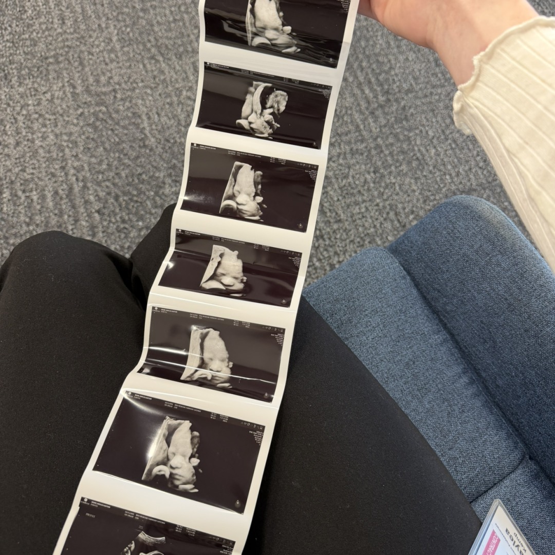 Photo shared by Haylea for their Babylist baby registry.