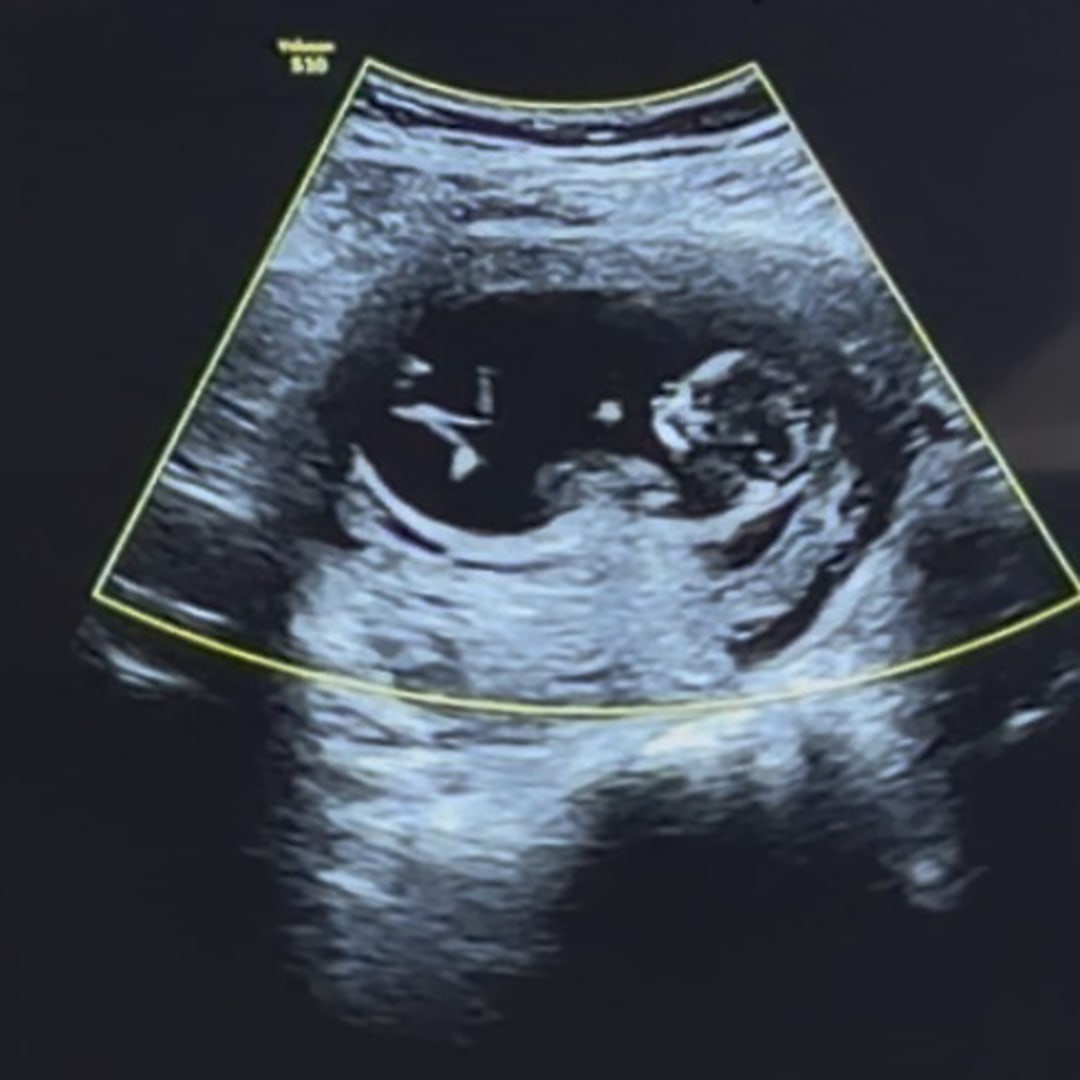 Photo shared by Jasmin for their Babylist baby registry.