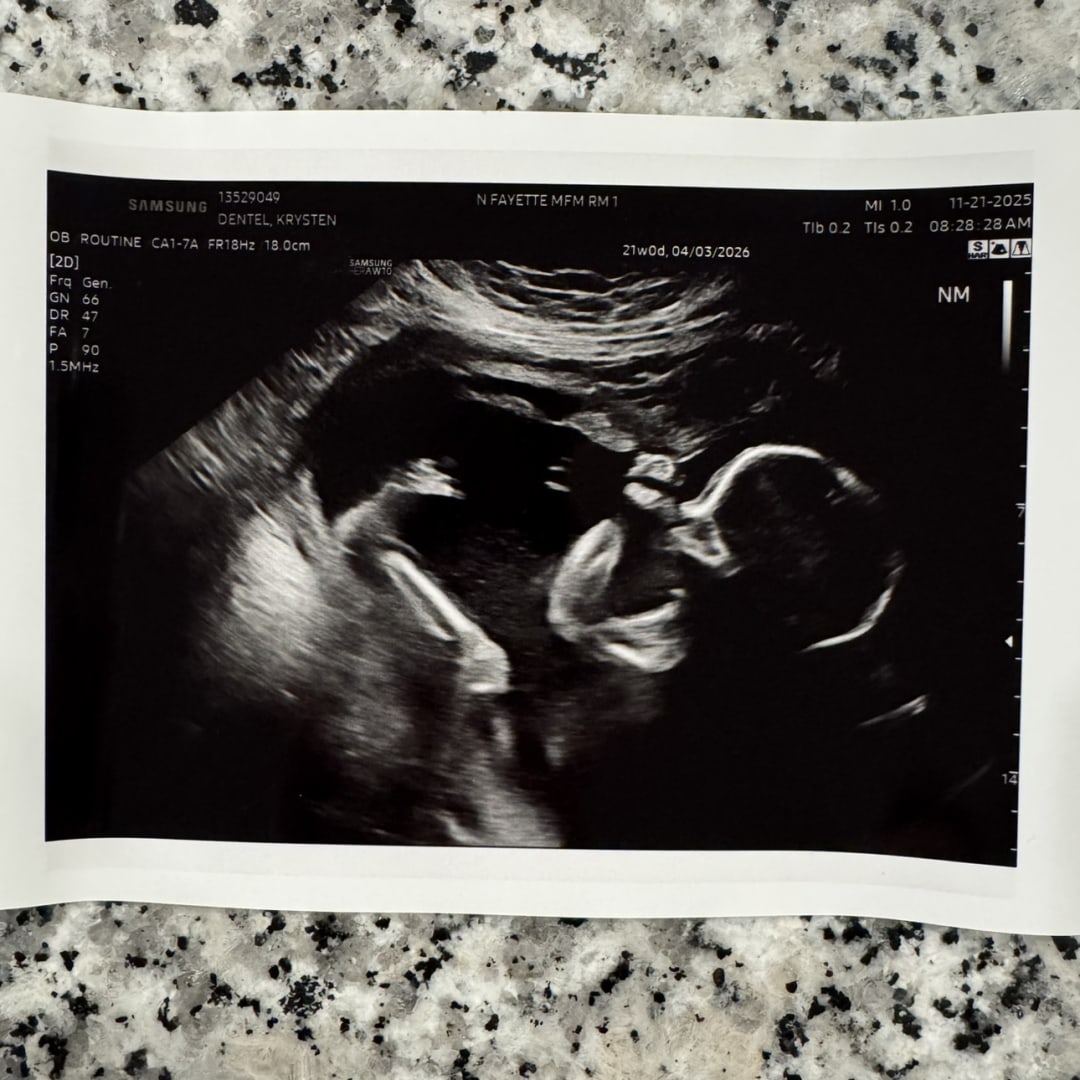 Photo shared by Krysten for their Babylist baby registry.