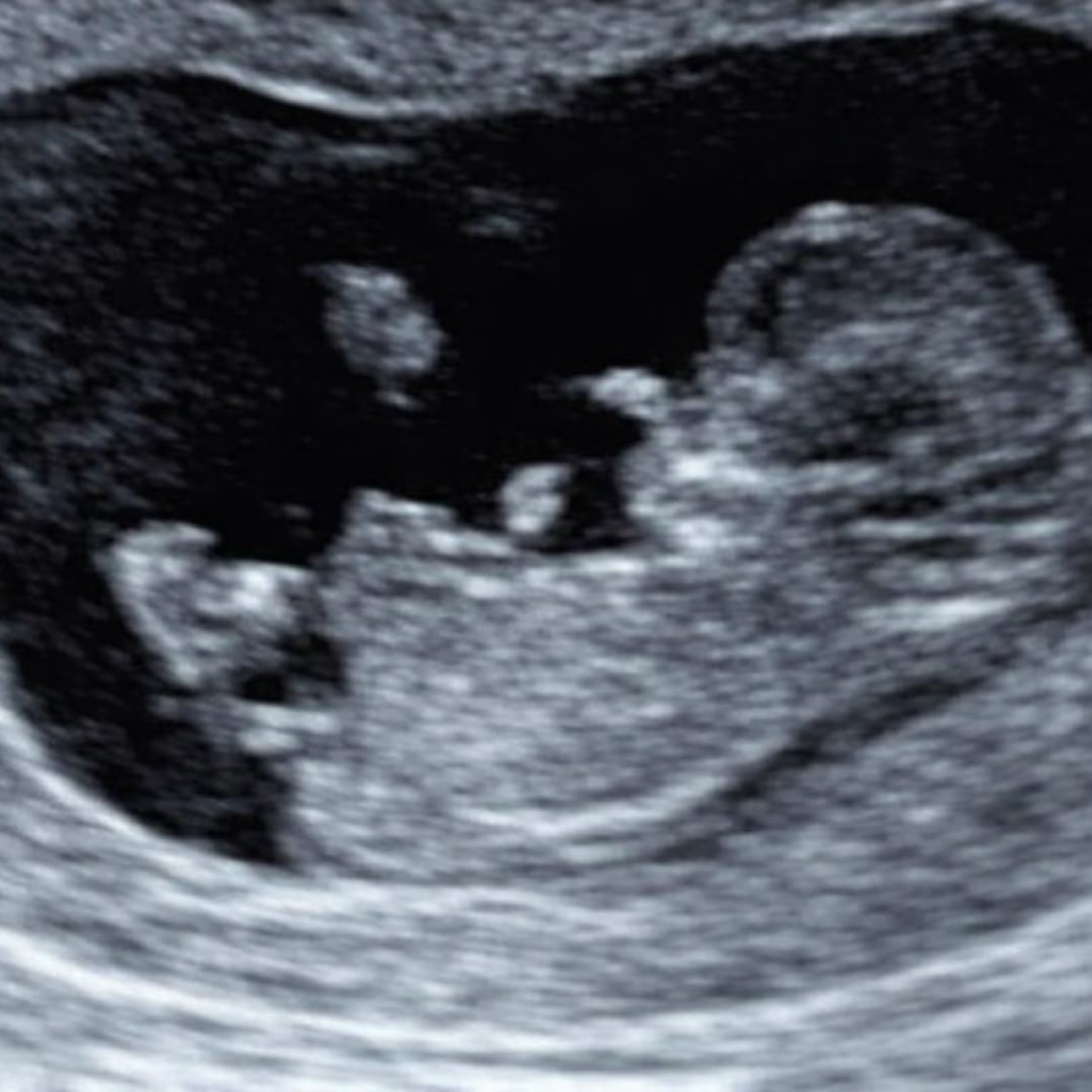 Photo shared by Breanna for their Babylist baby registry.