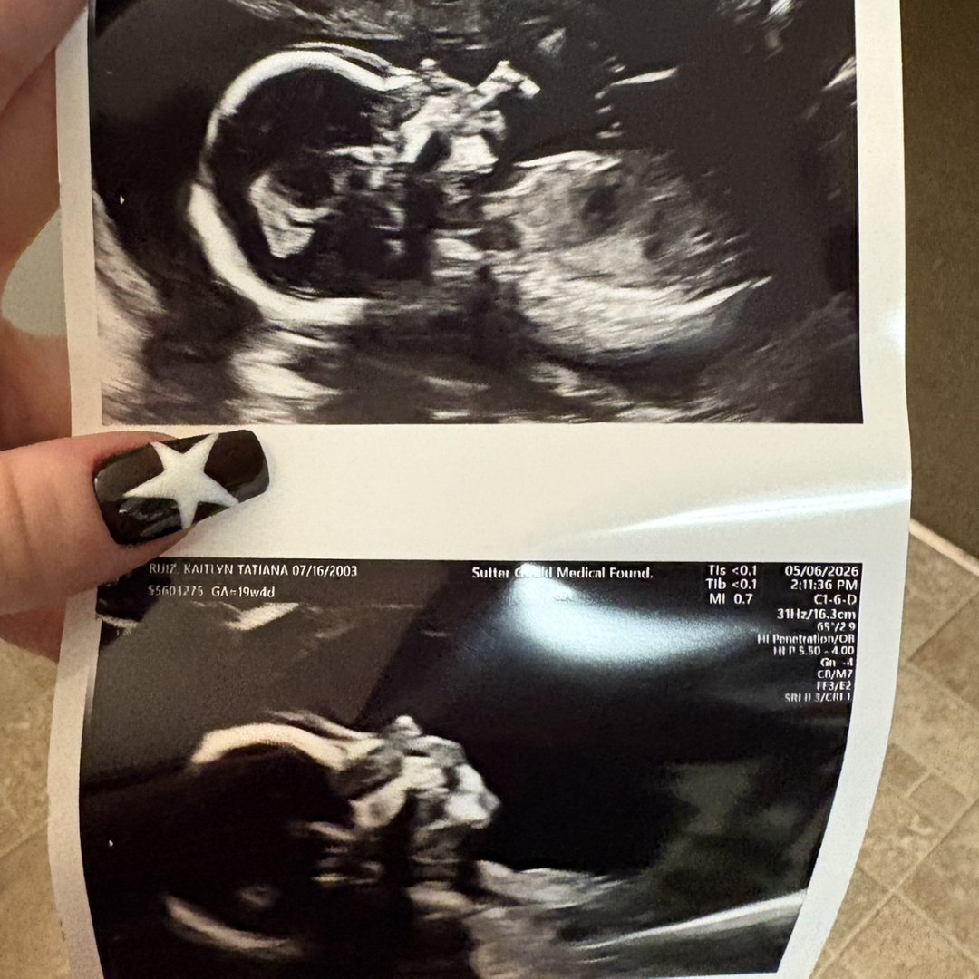 Photo shared by Kaitlyn for their Babylist baby registry.