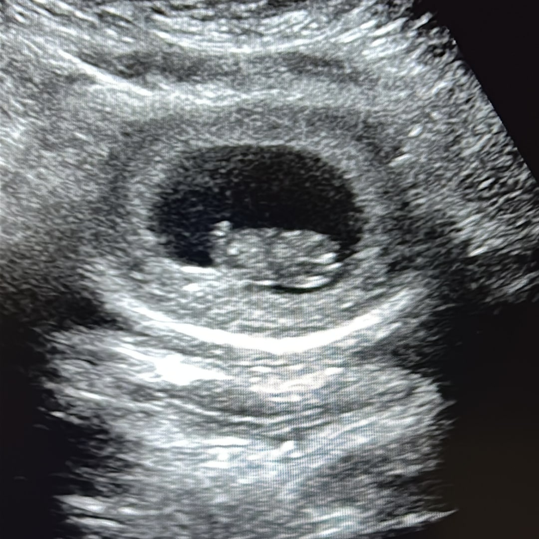 Photo shared by Erica for their Babylist baby registry.