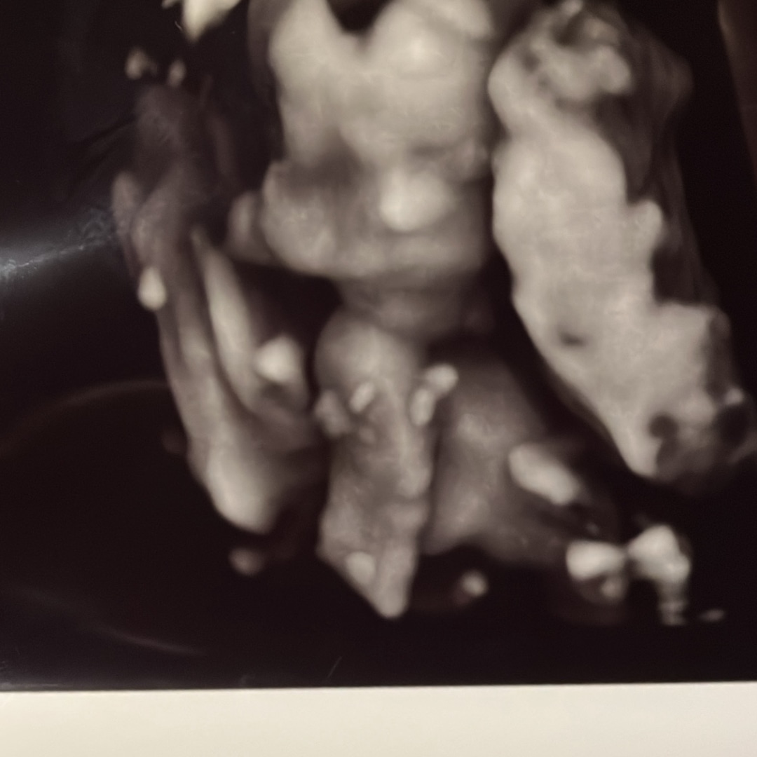 Photo shared by Talia for their Babylist baby registry.