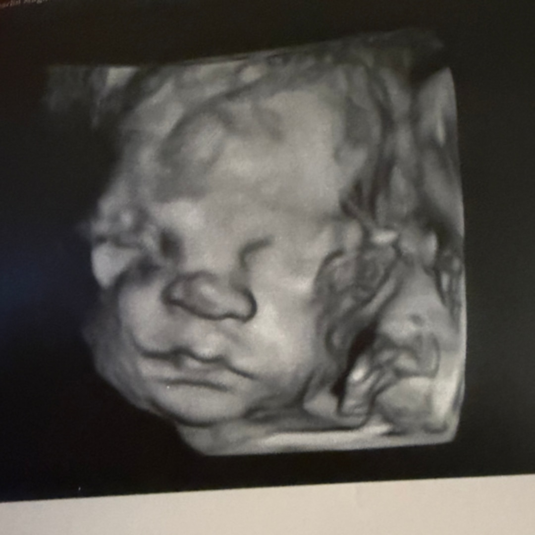 Photo shared by Darlin for their Babylist baby registry.