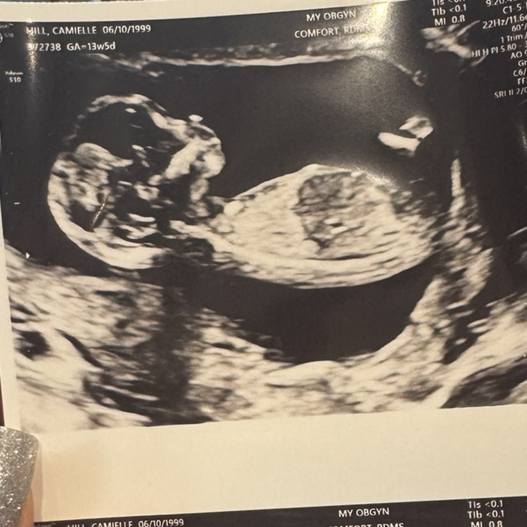 Photo shared by Camielle for their Babylist baby registry.