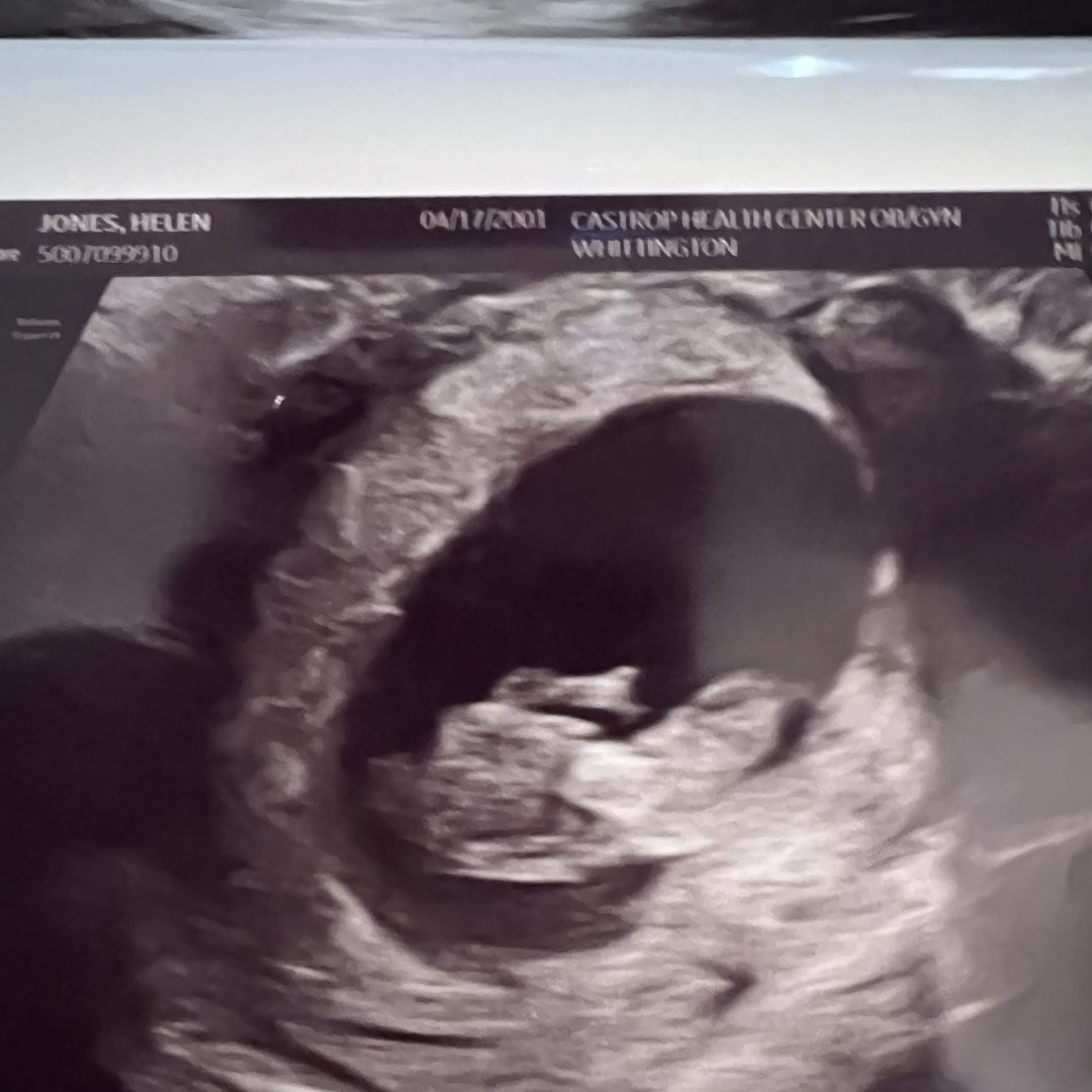 Photo shared by Jonah for their Babylist baby registry.